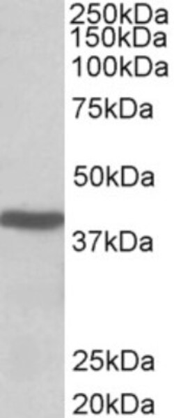 ACAT1 Antibody, Novus Biologicals 0.1mg; Unlabeled:Antibodies, Polyclonal